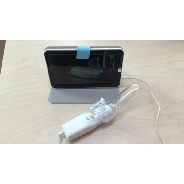 Perinav Camera China Vaginal Camera Cervix Camera Digital Electronic Video Colposcope ...