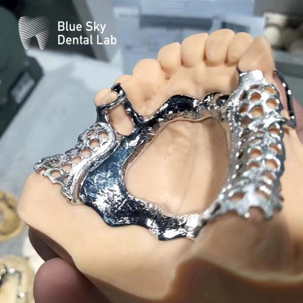 China Removable Denture Rpd Framework Design Metal Partial Denture ...